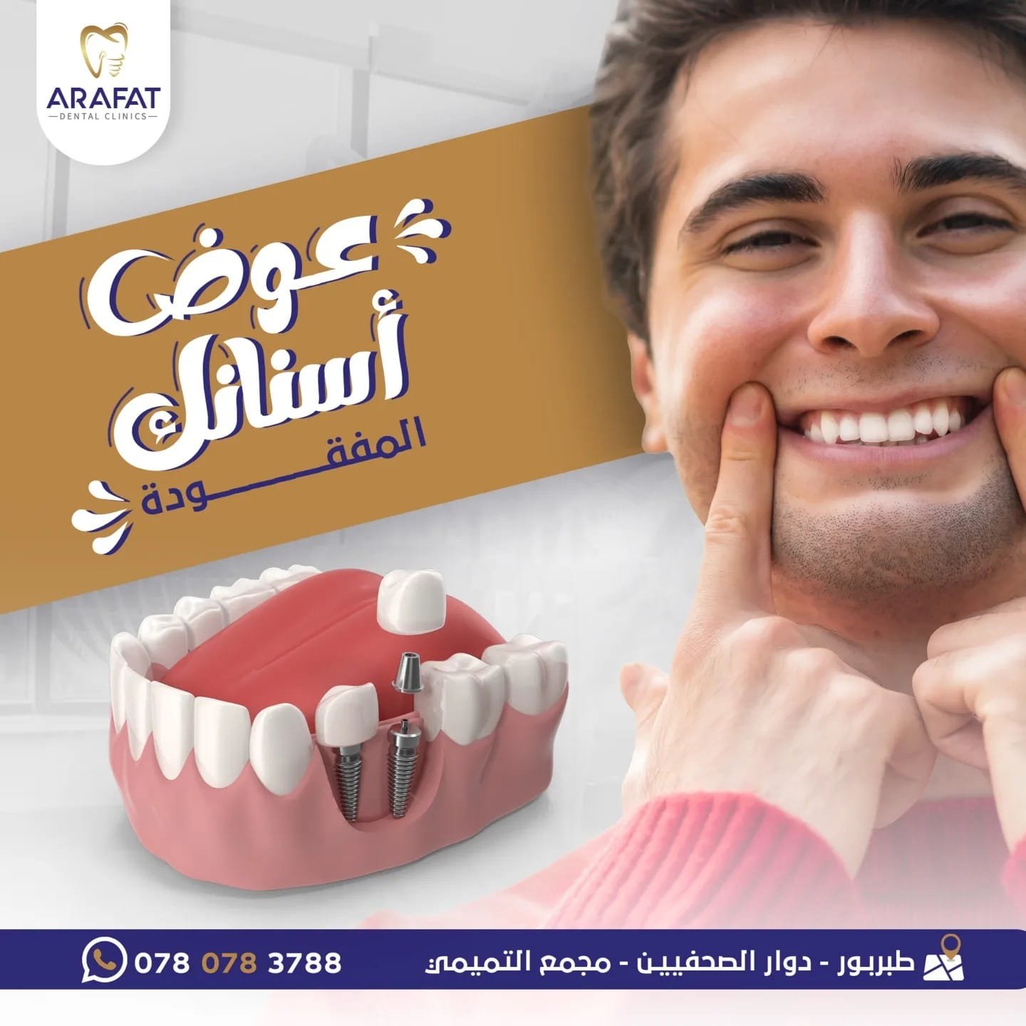 زراعة-الأسنان-في-طبربور