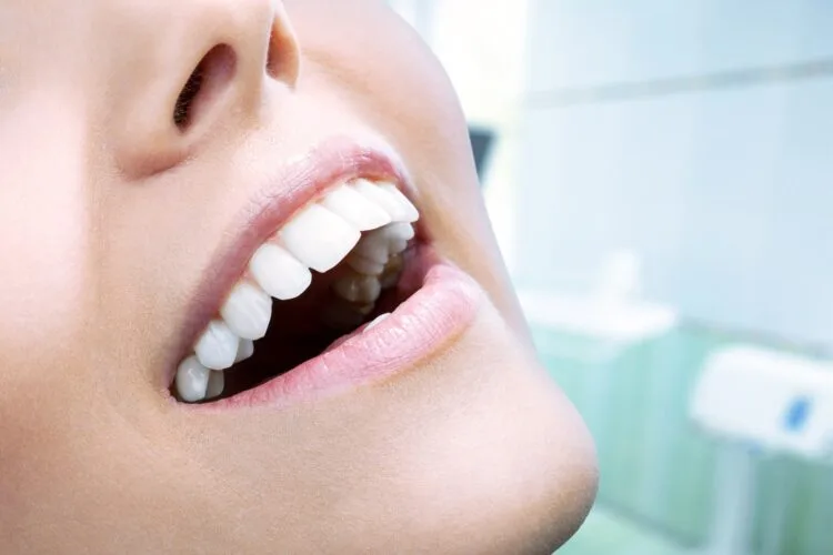 أفضل عيادة أسنان في طبربور تقدم تبييض الأسنان الفوري