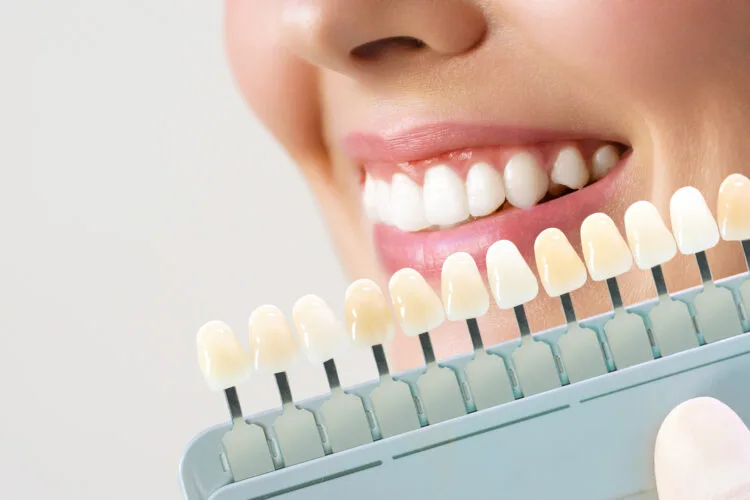 بورسلان الأسنان تركيب الأسنان في طبربور أفضل التركيبات السنية