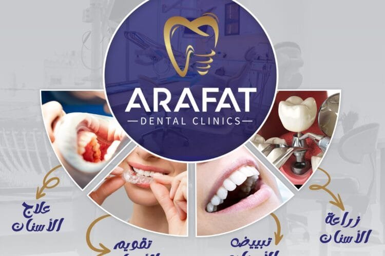 أفضل عيادة أسنان في عمان طبربور