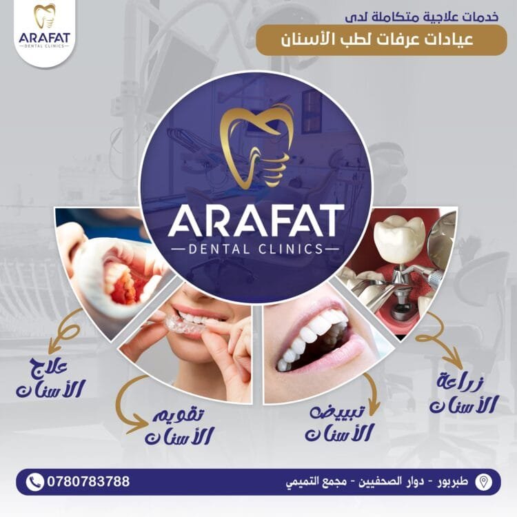 أفضل عيادة أسنان في عمان طبربور